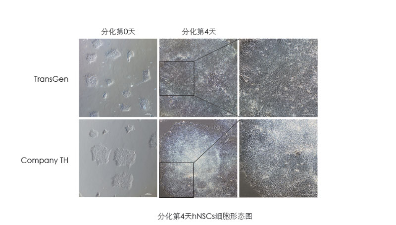 喜訊：全式金獲一項發(fā)明專利授權(quán)--“一種用于人神經(jīng)系統(tǒng)細(xì)胞培養(yǎng)和人多能性干細(xì)胞向神經(jīng)系統(tǒng)細(xì)胞分化的營養(yǎng)添加劑”