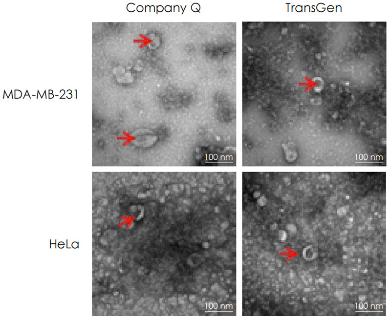 電鏡檢測(cè) 電鏡檢測(cè)
